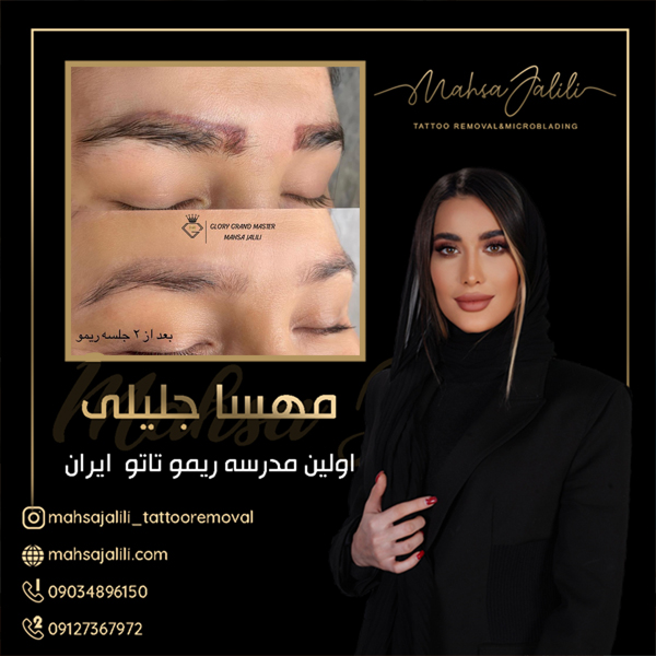 آموزش ریموو تاتو ابرو با جدیدترین روش عکس شماره 3