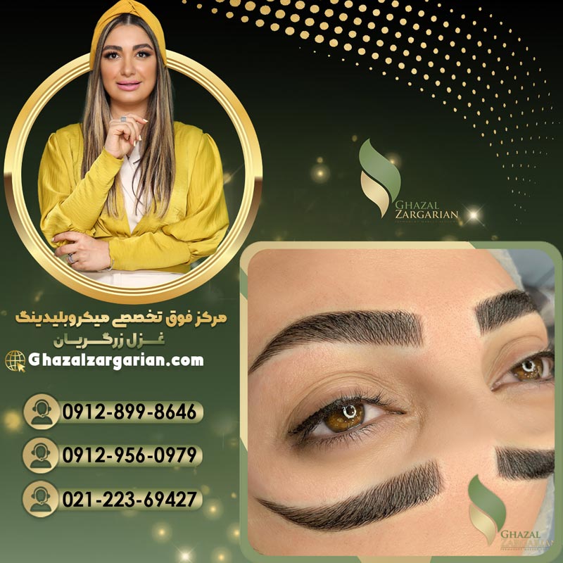 میکروبلیدینگ غزل زرگریان در تهران عکس شماره 5