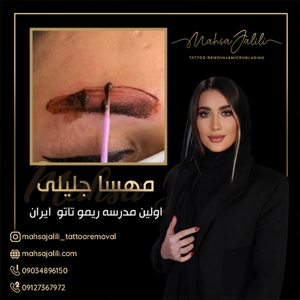 آموزش ریموو تاتو ابرو با جدیدترین روش عکس شماره 5