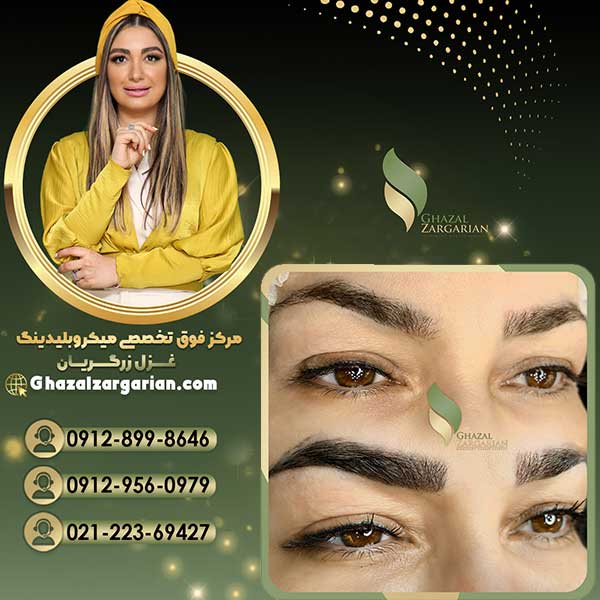 پاک کردن میکروبلیدینگ ابرو به صورت حرفه ای عکس شماره 2