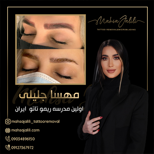 آموزش ریموو تاتو ابرو با جدیدترین روش عکس شماره 2