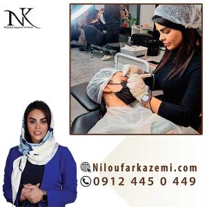 ریموو تاتو قدیمی در بهترین مرکز ریموو تاتو