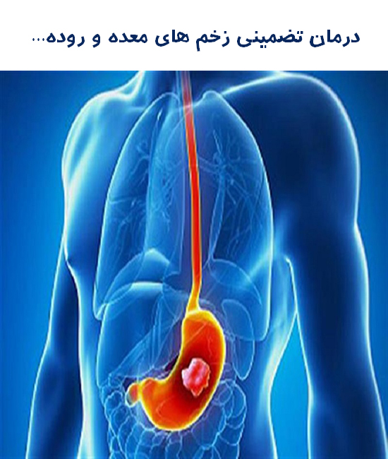 بهبودی و درمان کامل زخم معده به طور تضمینی...