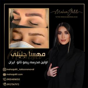 آموزش ریموو تاتو با بهترین استاد 