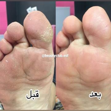 پدیکور - کف سابی - پارافین تراپی اصفهان-09302002868 