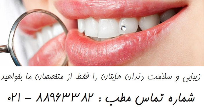 بهترین دندانپزشکی مرکز تهران عصب کشی دندان   