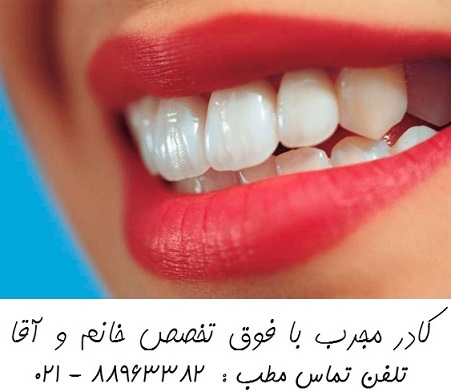خدمات دندانپزشکی زیبایی سفید کردن دندان طراحی لبخند هالیوودی 