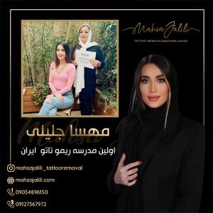 آموزش ریموو تاتو ابرو با جدیدترین روش