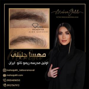 مدرسه تخصصی ریموو تاتو در تهران 