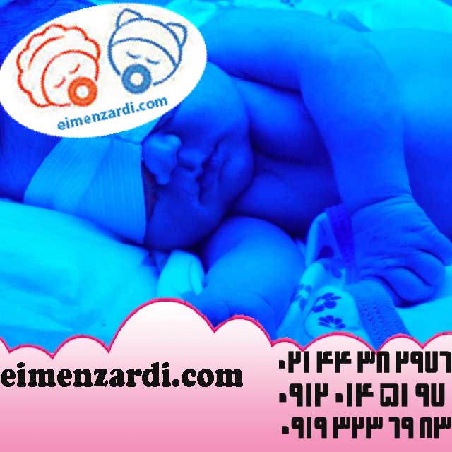 فروش دستگاه زردی نوزاد و فتوتراپی شرکت ایمن زردی